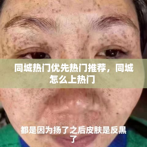 同城熱門優(yōu)先熱門推薦，同城怎么上熱門 